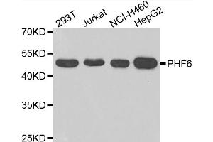 Western blot analysis of extracts of various cell lines, using PHF6 antibody (ABIN4904747) at 1:1000 dilution. (PHF6 antibody)