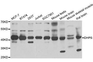 Western blot analysis of extracts of various cell lines, using DHPS antibody. (DHPS antibody  (AA 1-369))