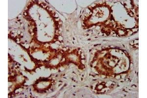 Immunohistochemistry (IHC) image for anti-Nuclear Factor-kB p65 (NFkBP65) (AA 1-210) antibody (ABIN7172586)