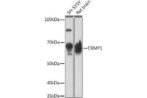 Western blot analysis of extracts of various cell lines, using CRMP1 Rabbit mAb (ABIN7266468) at 1:1000 dilution. (CRMP1 antibody)