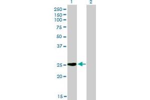 Western Blot analysis of IGSF6 expression in transfected 293T cell line by IGSF6 monoclonal antibody (M01), clone 2A12. (IGSF6 antibody  (AA 29-241))