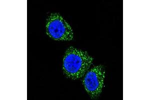 Confocal immunofluorescent analysis of MEN1 Antibody  (ABIN391614 and ABIN2841535) with Hela cell followed by Alexa Fluor 488-conjugated goat anti-rabbit lgG (green). (Menin antibody  (AA 584-615))