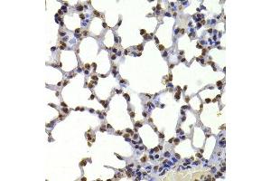 Immunohistochemistry of paraffin-embedded mouse lung using CBX5 antibody. (CBX5 antibody  (AA 1-100))