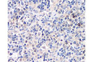 Immunohistochemistry analysis of paraffin-embedded rat lymph node using CD284 Polyclonal Antibody at dilution of 1:500. (TLR4 antibody)