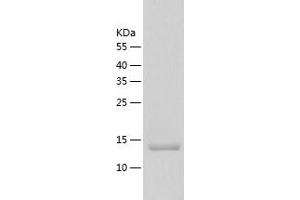 Western Blotting (WB) image for G Antigen 12F (GAGE12F) (AA 1-117) protein (His tag) (ABIN7123025) (G Antigen 12F Protein (GAGE12F) (AA 1-117) (His tag))