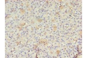 Immunohistochemistry of paraffin-embedded human pancreatic tissue using ABIN7167288 at dilution of 1:100 (RAB3A antibody  (AA 1-200))