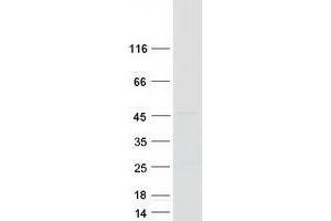 Western Blotting (WB) image for Tumor Necrosis Factor Receptor Superfamily, Member 10b (TNFRSF10B) (Transcript Variant 2) protein (Myc-DYKDDDDK Tag) (ABIN2713563)