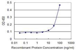 Detection limit for recombinant GST tagged SLC27A1 is 3 ng/ml as a capture antibody. (SLC27A1 antibody  (AA 44-137))