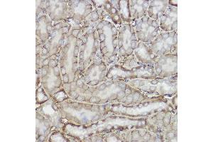 TRPC6 antibody  (AA 500-600)