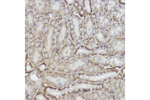 TRPC6 antibody  (AA 500-600)