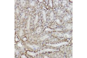 Immunohistochemistry of paraffin-embedded mouse kidney using TRPC6 Rabbit pAb (ABIN6133946, ABIN6149580, ABIN6149581 and ABIN6224178) at dilution of 1:150 (40x lens). (TRPC6 antibody  (AA 500-600))