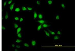 Image no. 4 for anti-Apoptosis Inhibitor 5 (API5) (AA 400-504) antibody (ABIN466131) (Apoptosis Inhibitor 5 antibody  (AA 400-504))
