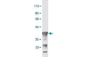 Western Blot detection against Immunogen (36. (PCDH20 antibody  (AA 395-494))