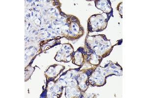 Immunohistochemistry of paraffin-embedded human placenta using  antibody (ABIN7265710) at dilution of 1:100 (40x lens). (ATG5 antibody)