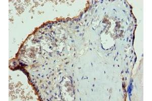 Immunohistochemistry of paraffin-embedded human placenta tissue using ABIN7147242 at dilution of 1:100 (PGS1 antibody  (AA 110-400))
