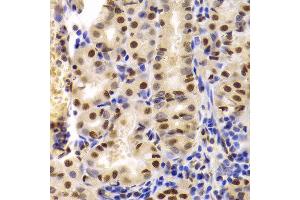 Immunohistochemistry of paraffin-embedded Human gastric using XRCC5 antibody at dilution of 1:100 (40x lens). (XRCC5 antibody)