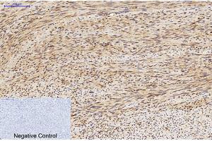 Immunohistochemical analysis of paraffin-embedded human uterus tissue. (MAP1LC3A antibody)