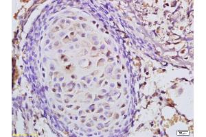 Formalin-fixed and paraffin embedded mouse embryo tissue labeled with Anti-CARM1 Polyclonal Antibody, Unconjugated (ABIN753793) at 1:200 followed by conjugation to the secondary antibody (CARM1 antibody  (AA 411-510))