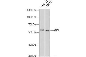 Adenylosuccinate Lyase antibody