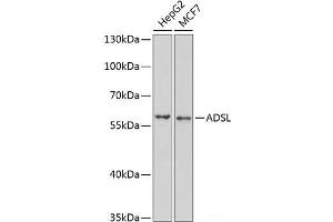 Western blot analysis of extracts of various cell lines using ADSL Polyclonal Antibody at dilution of 1:1000. (Adenylosuccinate Lyase antibody)