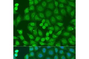 Immunofluorescence analysis of U2OS cells using ZFYVE16 Polyclonal Antibody at dilution of 1:100. (ZFYVE16 antibody)