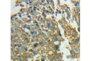 Used in DAB staining on fromalin fixed paraffin-embedded Ovary tissue (SIRPG antibody  (AA 111-372))
