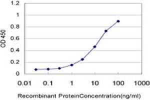 Detection limit for recombinant GST tagged KIAA0261 is approximately 0. (WAPAL antibody  (AA 1-402))