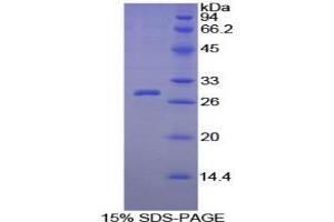 SDS-PAGE analysis of Guinea Pig C-Reactive Protein. (CRP Protein)