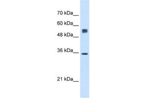 Western Blotting (WB) image for anti-Signal Sequence Receptor, alpha (SSR1) antibody (ABIN2462851) (SSR1 antibody)