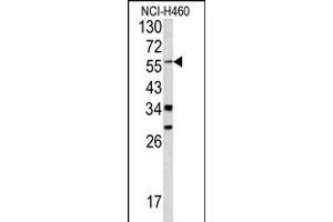 Western blot analysis of YAP1 antibody in NCI-H460 cell line lysates (35ug/lane) (YAP1 antibody  (C-Term))