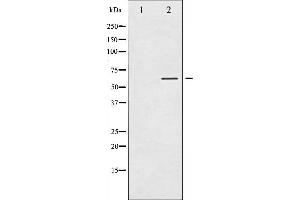 Western blot analysis of Tyrosine Hydroxylase phosphorylation expression in RAW264. (Tyrosine Hydroxylase antibody  (pSer40))