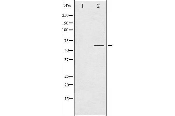 Tyrosine Hydroxylase antibody  (pSer40)
