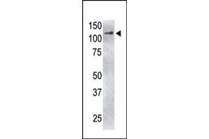 Image no. 1 for anti-Ubiquitin Specific Peptidase 4 (USP4) (C-Term) antibody (ABIN357526) (USP4 antibody  (C-Term))