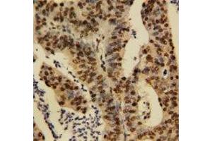Image no. 1 for anti-Tumor Necrosis Factor, alpha-Induced Protein 1 (Endothelial) (TNFAIP1) (N-Term) antibody (ABIN1495136)