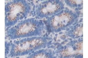 Detection of SDF4 in Rat Colon Tissue using Polyclonal Antibody to Stromal Cell Derived Factor 4 (SDF4) (SDF4 antibody  (AA 184-382))
