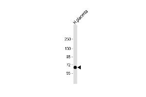 Anti-STT3A Antibody (Center) at 1:2000 dilution + human placenta lysate Lysates/proteins at 20 μg per lane. (STT3A antibody  (AA 476-507))