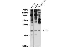 Western blot analysis of extracts of various cell lines, using CSF3 antibody (ABIN6127710, ABIN6139100, ABIN6139101 and ABIN6221772) at 1:1000 dilution. (G-CSF antibody  (AA 30-207))
