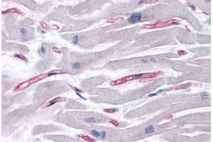 Human Heart: Formalin-Fixed, Paraffin-Embedded (FFPE) (SLAIN1 antibody  (C-Term))