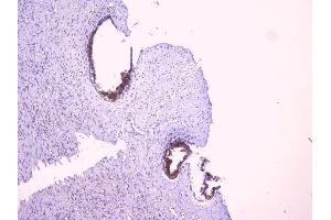 IHC analysis of PBP using anti-PBP antibody (ABIN5693043).