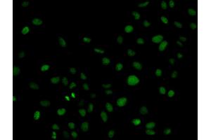 Immunofluorescence analysis of HeLa cell using PLCG2 antibody. (Phospholipase C gamma 2 antibody  (AA 1-300))
