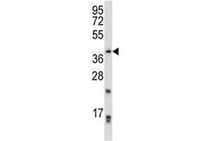 PITX2 antibody western blot analysis in CEM lysate. (PITX2 antibody  (AA 42-71))