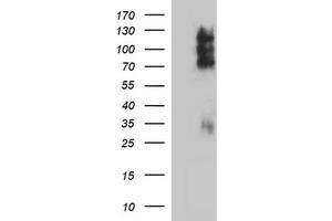 Image no. 1 for anti-CD44 (CD44) antibody (ABIN1497320) (CD44 antibody)