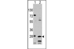 Image no. 1 for anti-Growth Factor Receptor-Bound Protein 2 (GRB2) (Tyr209) antibody (ABIN358793) (GRB2 antibody  (Tyr209))