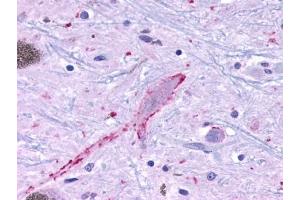 Immunohistochemical staining of Brain (Neurons and glia) using anti- MRGPRF antibody ABIN122237 (Mrgprf antibody  (Cytoplasmic Domain))