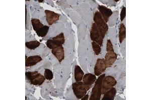 Immunohistochemical staining (Formalin-fixed paraffin-embedded sections) of human skeletal muscle with MYH6 monoclonal antibody, clone CL2162  shows strong cytoplasmic immunoreactivity in a subset of striated muscle fibers. (MYH6 antibody)