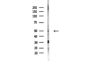 anti-Protein Phosphatase 4, Regulatory Subunit 1-Like (PPP4R1L) antibody