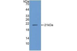 Detection of Recombinant ANP32A, Human using Polyclonal Antibody to Acidic Nuclear Phosphoprotein 32 Family, Member A (ANP32A) (PHAP1 antibody  (AA 2-175))