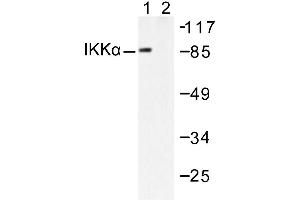 Image no. 1 for anti-conserved Helix-Loop-Helix Ubiquitous Kinase (CHUK) antibody (ABIN265477) (IKK alpha antibody)