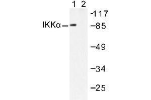 Image no. 1 for anti-conserved Helix-Loop-Helix Ubiquitous Kinase (CHUK) antibody (ABIN265477)