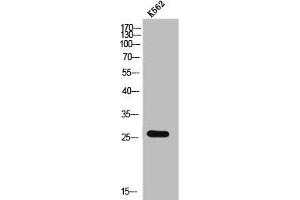 CMTM2 antibody  (C-Term)